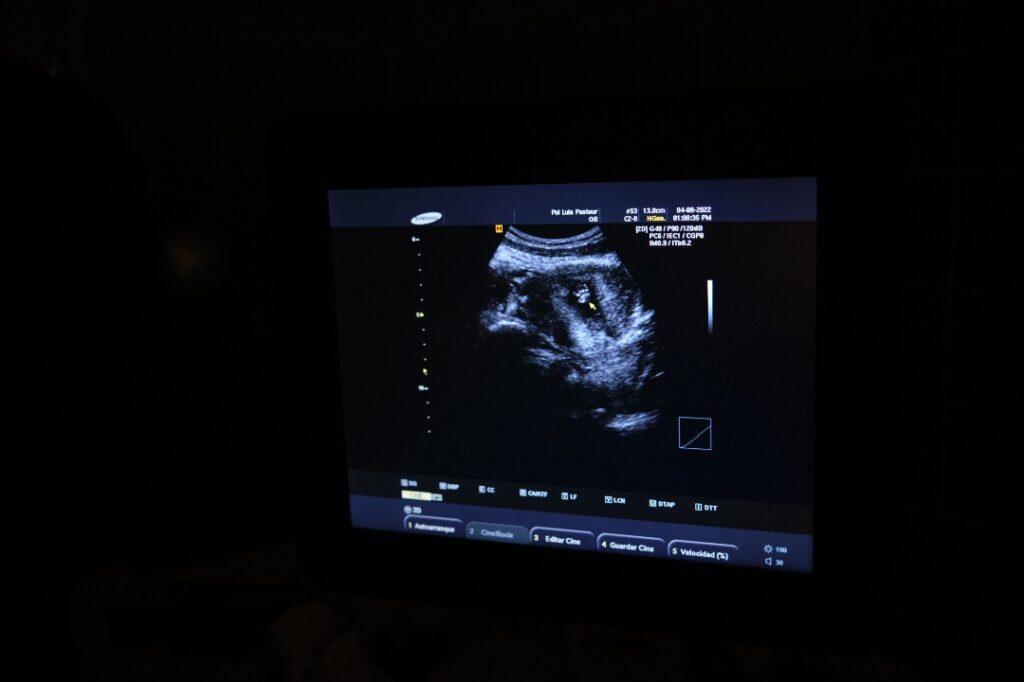 imagen de un ultrasonido