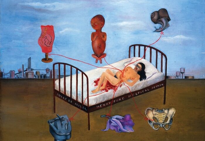 Obra de Frida Khalo pariendo en una cama de hospital.