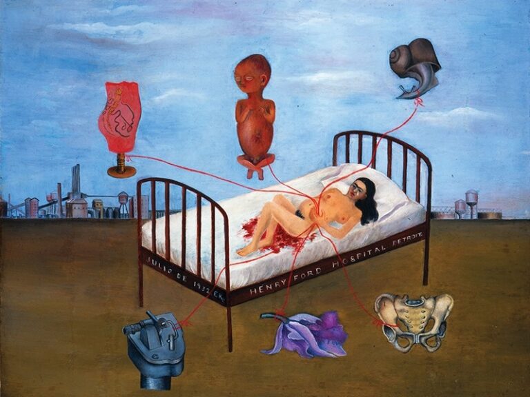 Obra de Frida Khalo pariendo en una cama de hospital.